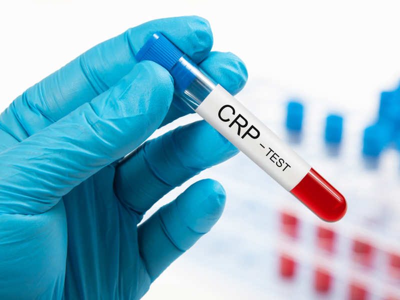 C-reaktif Protein (CRP) Testi